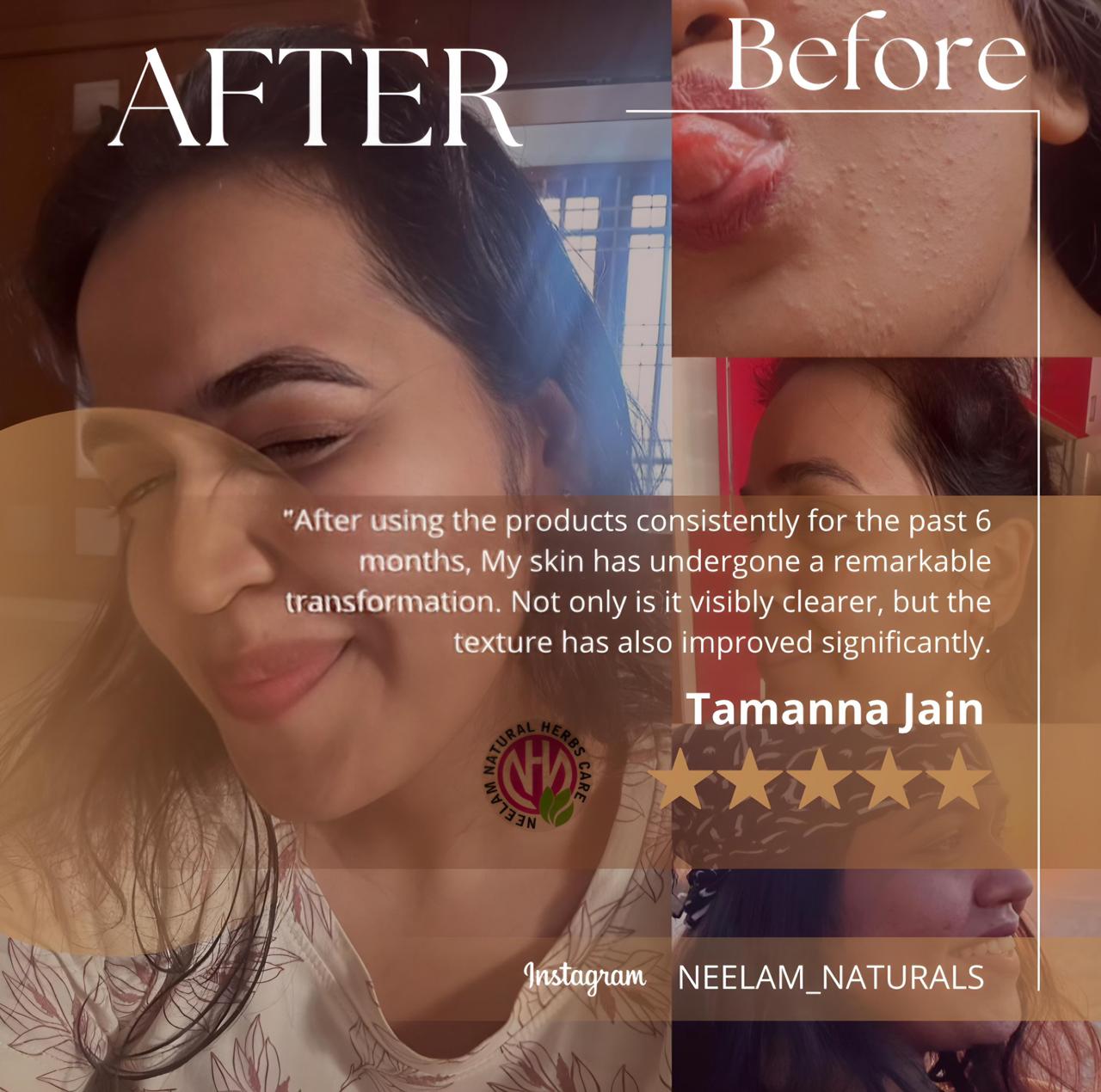 Patient Transformation 2